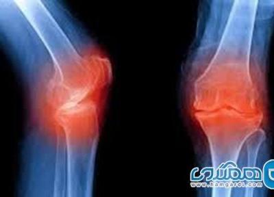 راهکارهایی برای پیشگیری از بروز آرتروز