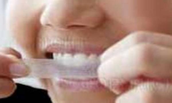 محدودیت سفیدکننده های خانگی دندان